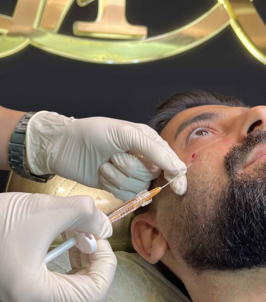 مزوتراپی در کلینیک دکتر روزبه معصومی