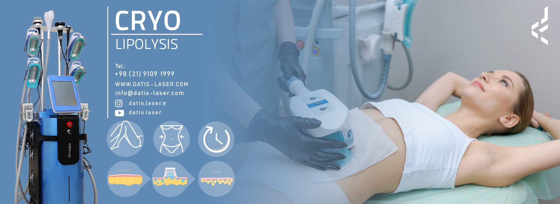 کرایولیپولیز در رشت | روش ایمن و سریع برای لاغری موضعی بدن