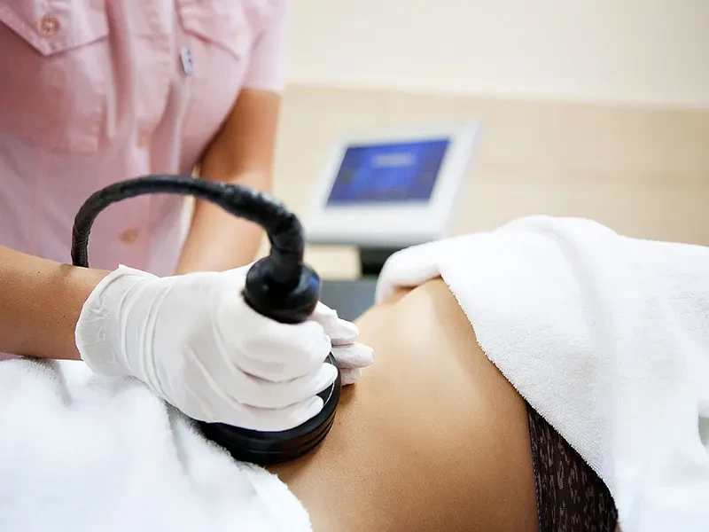 لاغری موضعی در گیلان | حذف چربی‌های Stubborn با تکنولوژی روز