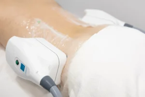 لاغری موضعی در گیلان | حذف چربی‌های Stubborn با تکنولوژی روز