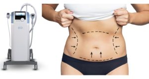 کوچک‌کردن شکم با دستگاه در رشت | مناسب برای مادران بعد از زایمان