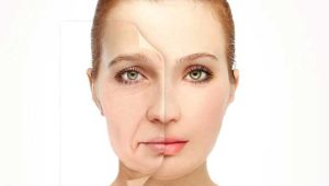 بهترین درمان برای شلی پوست در رشت | لیفت صورت با اندولیفت