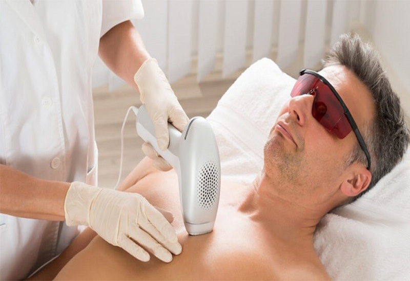 مرکز تخصصی لیزر موهای زاید در رشت | راهنمای انتخاب دستگاه مناسب نوع پوست